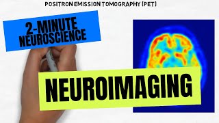 2Minute Neuroscience Neuroimaging [upl. by Atinev136]