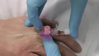 Cannulation How to gain IV access [upl. by Cavuoto]