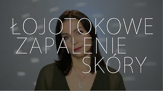 Łojotokowe zapalenie skóry [upl. by Eba]