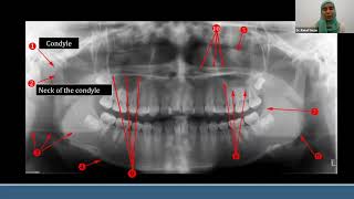 Interpretation of Panoramic Radiography with Interactive Cases [upl. by Paley701]