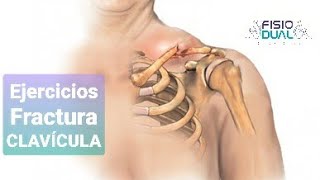 Ejercicios para Fractura de CLAVÍCULA [upl. by Ilrak]