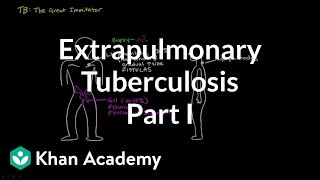 Extrapulmonary TB part 1  Infectious diseases  NCLEXRN  Khan Academy [upl. by Binni]