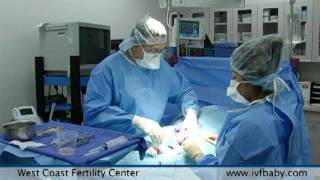 Risks of Tubal Reversal Surgery [upl. by Inman]