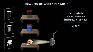 How to Interpret a Chest XRay Lesson 1  An Introduction [upl. by Lay]