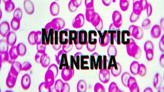 Microcytic Anemia updated 2021  CRASH Medical Review Series [upl. by Ashbaugh]