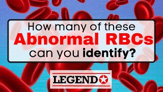 How many abnormal RBC forms can you identify  Legend Review Center [upl. by Munshi]