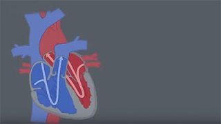 Congenital Heart Defects CHDs [upl. by Jonna]