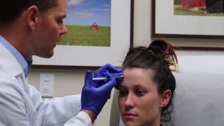 Botox For Migraines [upl. by Conrad]