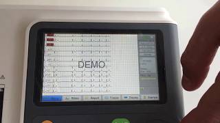 ECG Elettrocardiografo BIOCARE iE300  36 canali  Interpretativo [upl. by Huoh]