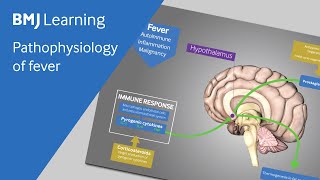 Pathophysiology of fever explained [upl. by Titos]