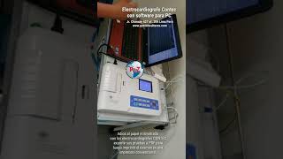 Electrocardiografo Contec con software para PC [upl. by Adlihtam189]