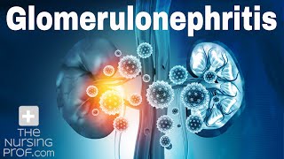 Renal Emergencies Glomerulonephritis [upl. by Marni]