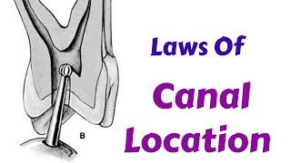 How to Find Canals in RCT  Laws Of Canal Location During ACP  Endodontic Lecture amp Tutorial [upl. by Brandon251]