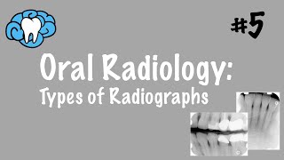 Oral Radiology  Types of Radiographs  INBDE ADAT [upl. by Narud310]