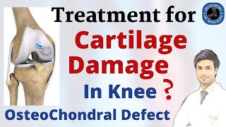 Knee Cartilage Damage Treatment  ChondralOsteochondral Defect Treatment Explained in Detail [upl. by Nart]