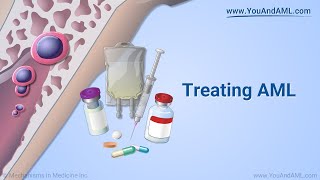 Treating AML [upl. by Aurelea]