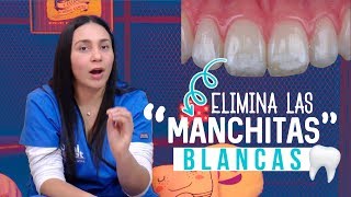 Manchas Blancas en los Dientes ¡Como QUITARLAS 👌 [upl. by Jacobine21]