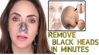 Home Made Blackheads Removing Strip  Remove From Nose Instantly [upl. by Jaf]