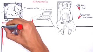 Acute Coronary Syndrome DETAILED Overview MI STEMI NSTEMI [upl. by Japeth]