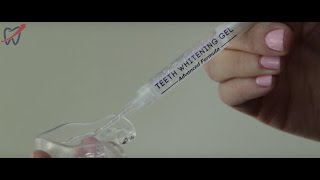 Teeth Whitening Syringe and Tray Instructions [upl. by Aelyak]