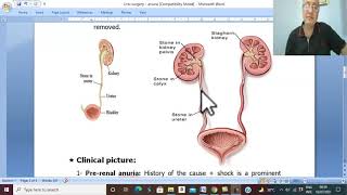 Urosurgery in Arabic 17 Anuria  part 1   by Dr Wahdan [upl. by Ecnarepmet]