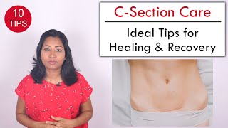 10 Tips to help Heal C Section wound  Post Delivery Care [upl. by Llertnac534]