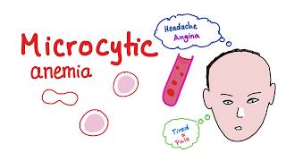 Microcytic Anemia introduction [upl. by Elias]