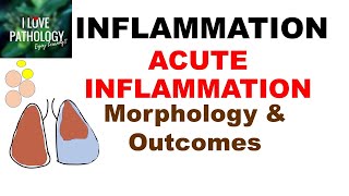 INFLAMMATION Part7 MORPHOLOGY amp OUTCOMES of Acute Inflammation [upl. by Strep540]