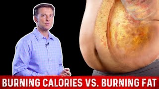 Burning Calories vs Burning FAT Calories – Dr Berg [upl. by Bravin996]