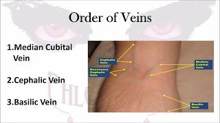 Phlebotomy The Order of Veins [upl. by Sateia194]