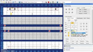 Charting Furcations and Mobility in Dentrix [upl. by Rexferd820]