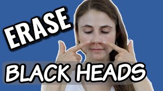 Erase blackheads dermatologist tips Dr Dray [upl. by Janetta]