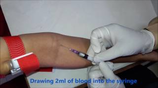 Intra Venous IV blood collection technique [upl. by Atinaej]