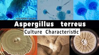 Aspergillus Terreus Culture Characteristic [upl. by Ycat]