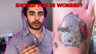 Is your tattoo INFECTEDOVERWORKED and what to do about it [upl. by Werna]