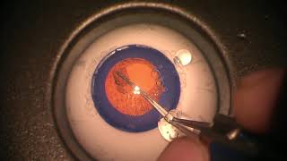 Simulated Surgery Phacoemulsification Creating Incision and Performing a Capsulorhexis [upl. by Guido]