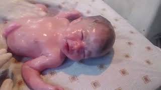 newborn baby came with vernix umbilical cord cutting process [upl. by Ayrb]