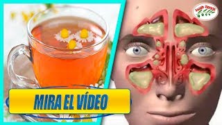 Los 5 mejores remedios para aliviar la sinusitis [upl. by Allegna986]