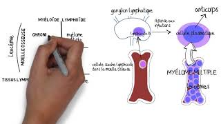 MyÃ©lome Multiple Signes Biologiques [upl. by Latsyek]