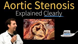 Echocardiography Essentials Detecting aortic regurgitation [upl. by Wincer901]