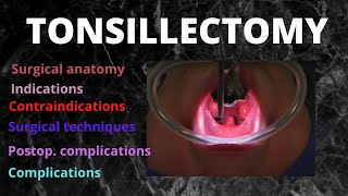 Tonsillectomy Video for Kids [upl. by Mitchell]