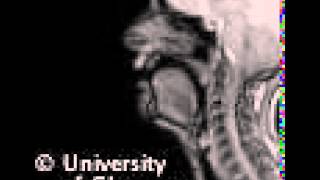 MRI voiceless alveolopalatal fricative [upl. by Iggep]