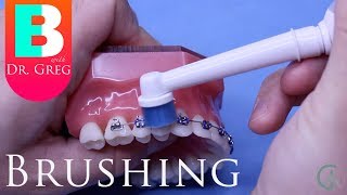 Brushing Your Teeth with Braces [upl. by Campney]