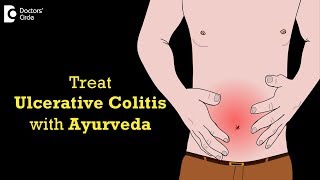 How to treat ulcerative colitis through Ayurveda  Dr Mini Nair [upl. by Macpherson555]