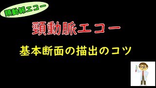 【頸動脈エコー】基本的な出し方と血管の走行。 [upl. by Cordalia]