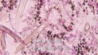 Aspergillus and Aspergillosis [upl. by Lertnek]