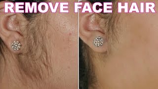 How To Remove Facial Hair Naturally  SkinCare Home Remedy  ShrutiArjunAnand [upl. by Dranyer]