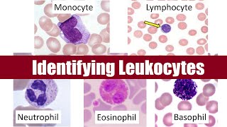 Identifying Leukocytes [upl. by Yeo]