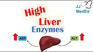 High Liver Enzymes  Aspartate vs Alanine Aminotransferase AST vs ALT  Causes [upl. by Cacia463]