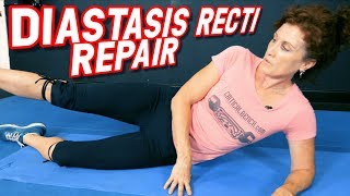 Top 5 Exercises to REPAIR Diastasis Recti [upl. by Cruz]